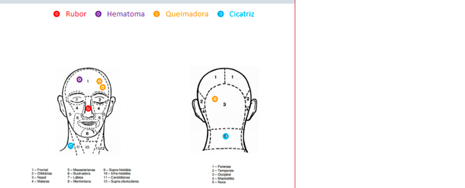 Usando Access - Marcar figuras
