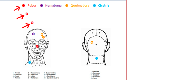 Usando Access - Marcar figuras
